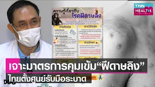 โรคฝีดาษลิงมีอาการอย่างไรบ้าง