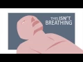 Agonal Breaths in Cardiac Arrest - Would you notice