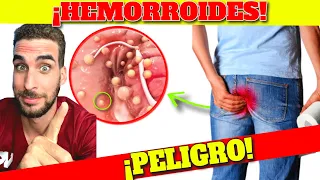 Download ¡FUE REVELADO! SÍNTOMAS de ALARMA de HEMORROIDES| CURAR HEMORROIDES de MANERA NATURAL MP3