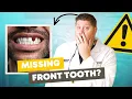 The 5 Best Options to REPLACE Your Missing Front Tooth Dental Implants Bridges More