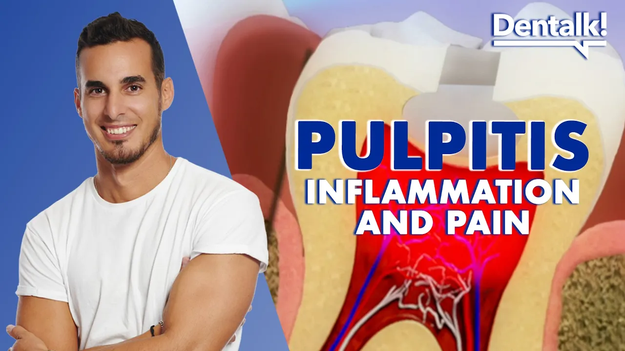 Outline Video TOOTHACHE? It could be PULPITIS - Tooth pain RELIEF and CAUSES of inflamed pulp | Dentalk! ©