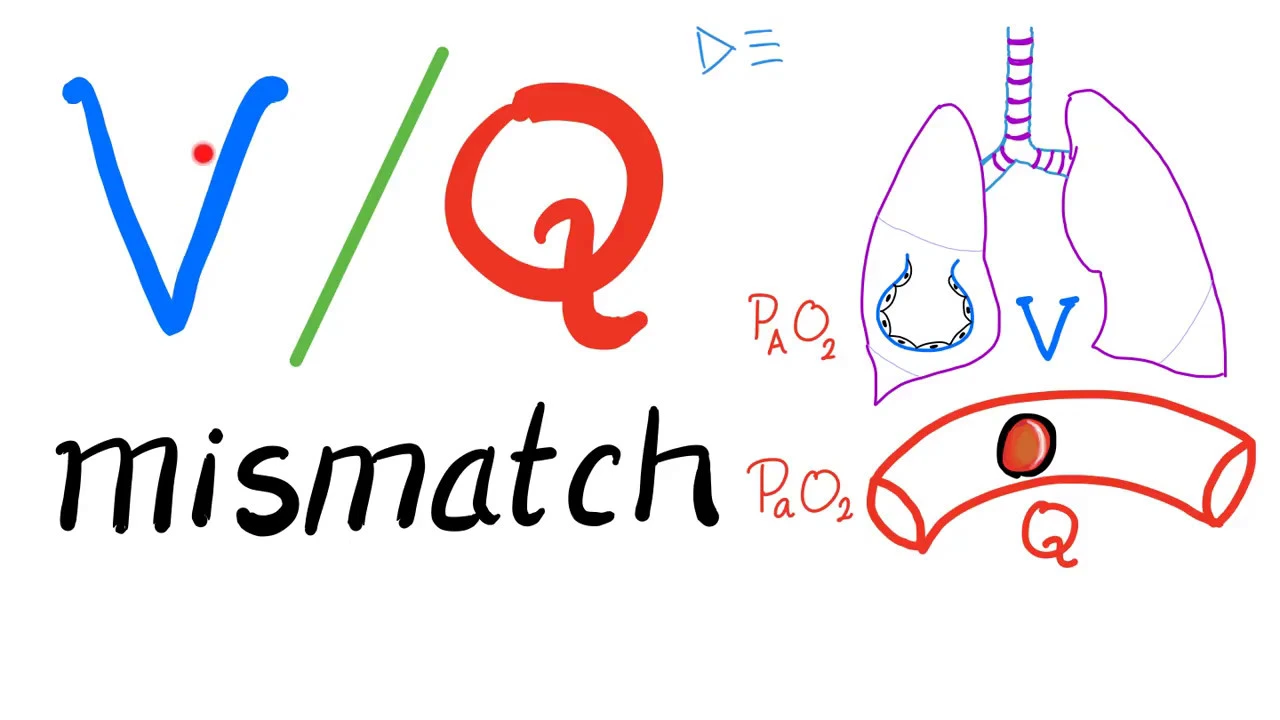 Ventilation/ Perfusion Ratio (V/Q) and V/Q Mismatch - Respiratory Physiology & Pulmonology