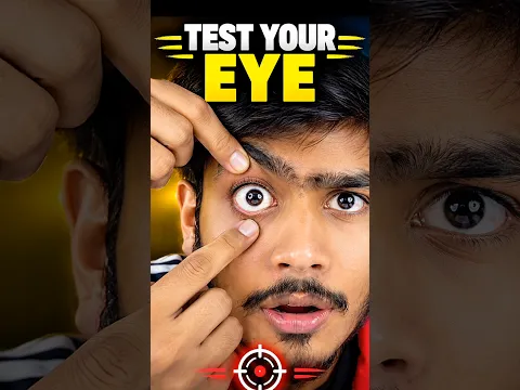 Test Your Eye👁️ Health Now..