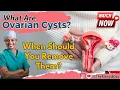 What Are Ovarian Cysts - When Should You Remove Them