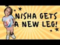 Download Lagu Her First Time Walking on a Prosthetic