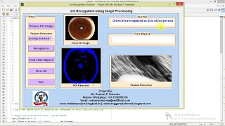 Iris Recognition System using Image Processing Matlab Project with Source Code