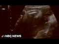 Custody battle between biological parents and surrogate