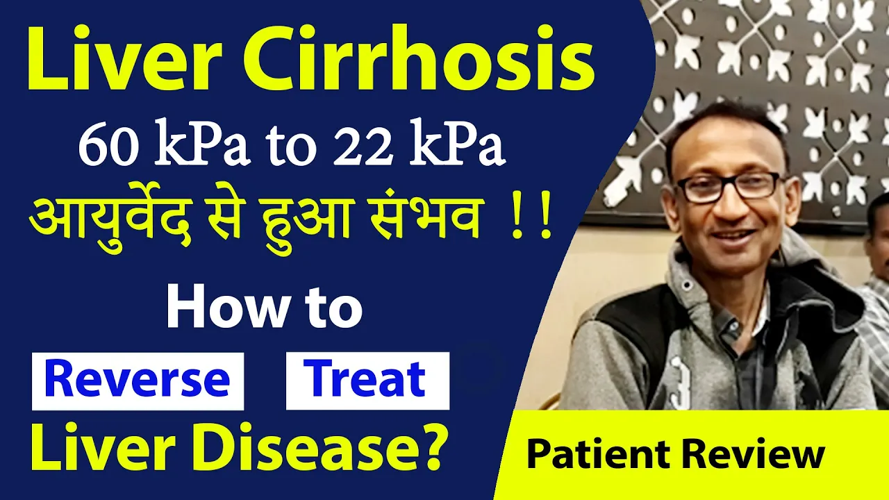 Watch Video Liver Cirrhosis Cure in Ayurveda - 60 kPa to 22 kPa