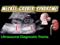Download Lagu Echografische diagnostische punten van het Meckel-Gruber-syndroom - belangrijke en minder belangr...