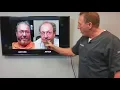 Case Study Kermit Hashimoto s Psoriasis a study in autoimmune recovery