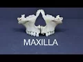 MAXILLA