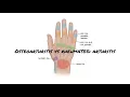 Mnemonic for hand joints osteoarthritis vs rheumatoid arthritis USMLE