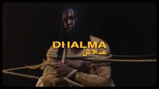          ع لاش                                            دندنها