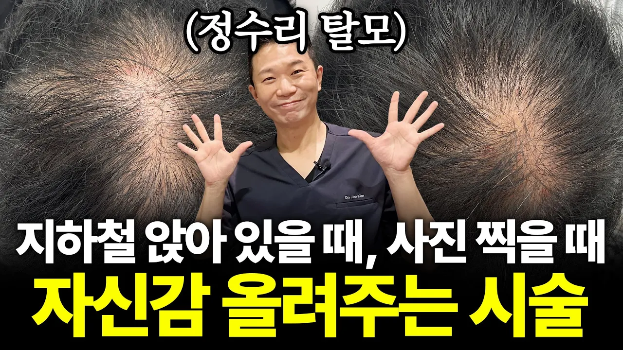 두피문신 진짜 자연스러울까? 사례 공개합니다