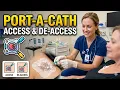 Port-a-cath Access Deaccess