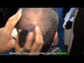 Download Lagu Hair Building Fiber Demo