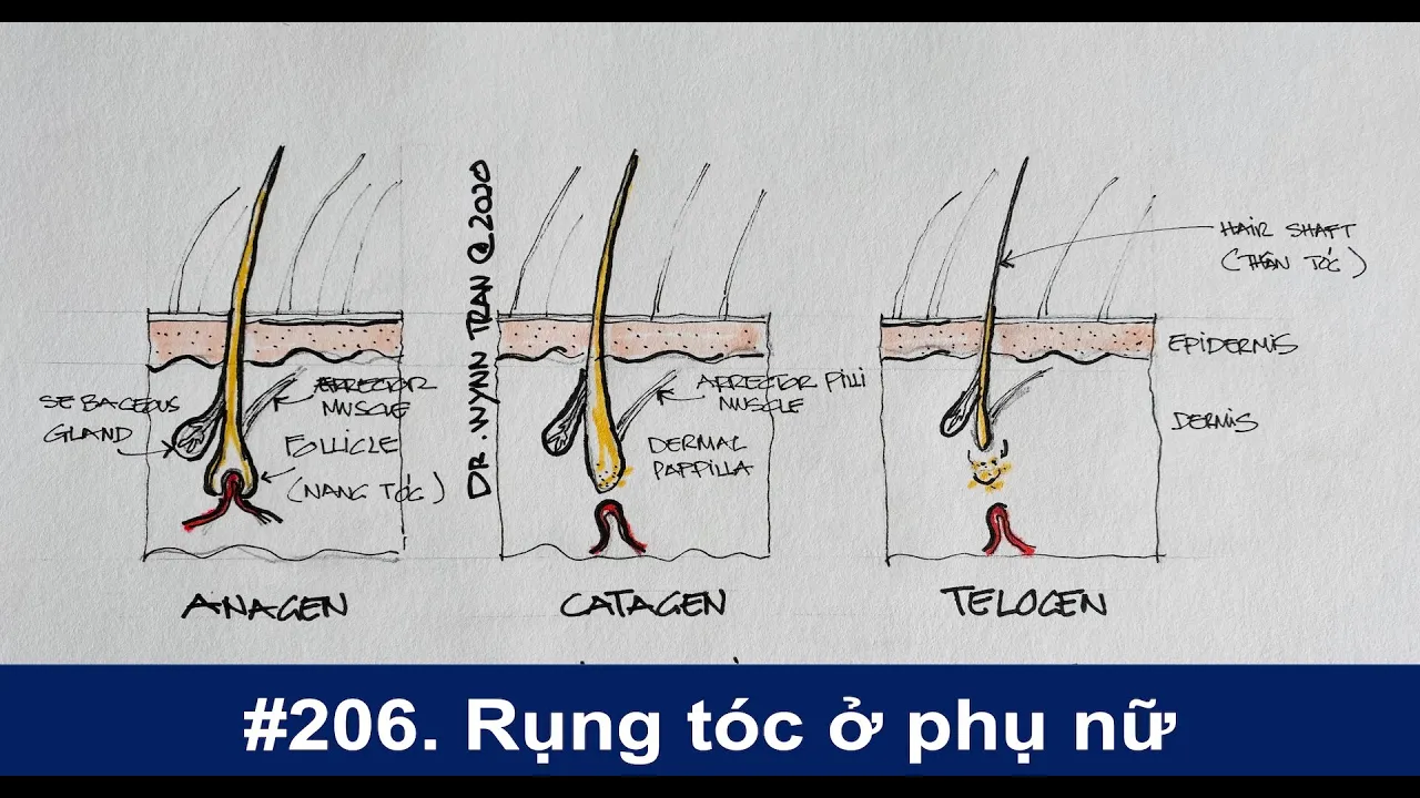 Outline Video #206. Rụng tóc ở phụ nữ và cách chữa trị?