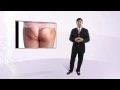 Can we fix cellulite or impressions or asymmetry