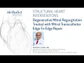Download Lagu Structural Heart Intervention Series: Degenerative MR treated with MTEER (Sachin Goel, MD)