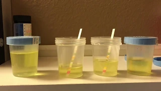 How To Detect Synthetic Urine QuickFix
