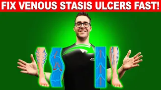 Download STOP Varicose Veins \u0026 Venous Stasis Ulcers FAST! MP3