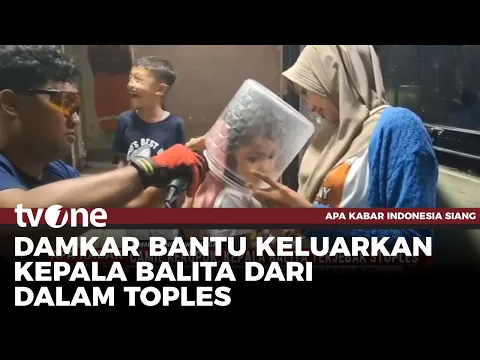Ada Saja Tingkahnya, Seorang Balita Ngide Masukan Kepalanya ke Wadah Kerupuk
