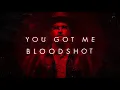 Sam Tinnesz - Bloodshot [Official Lyric Video]