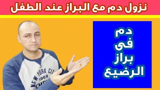 تعرفى على اسباب نزول دم مع البراز عند الرضع و الاطفال و ما خطورة الامر و كيفية التصرف 