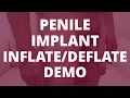 Download Lagu Penile Implant Demo (inflate/deflate) - 6 Months Post-Op