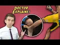 The Untold Side of the Most Famous Injury In UFC History - Anderson Silva s Broken Leg