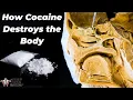 Download Lagu Why Cocaine Is So Incredibly Dangerous