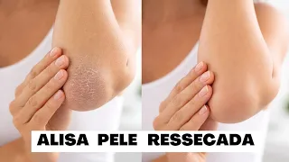 ALISA pele seca e Rachada USE 3x