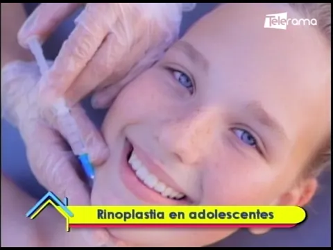 Estética al Día: Rinoplastia en adolescentes
