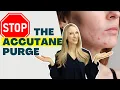 Accutane Acne Purge Do THIS