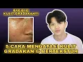 Lagu 5 CARA MENGATASI KULIT GRADAKAN \u0026 BERTEKSTUR!!! Kembalikan Kulit Sehatmu!