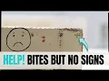 Help No Signs of Bed Bugs but I Have Bites