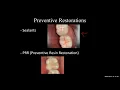 Hard Tissue Charting Lecture