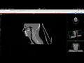 ITK VTK for StudierFenster Median Image Filter Example