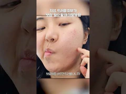 지성 여드름 피부는 건조 할 때 이렇게 합니다...