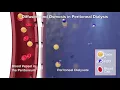 Satellite Healthcare PD Diffusion Osmosis 3D Animation