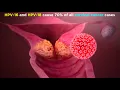 Human Papillomavirus HPV