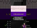 Lagu ECG Rhythm Pop Quiz: Can You Identify These EKG Rhythms? #shorts