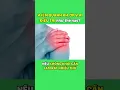 Download Lagu Viêm Quanh Khớp Vai - Muốn Điều Trị cần biết điều này! | Y học Thể thao Starsmec