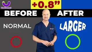 REALISTIC GAINS from PENILE STRETCHING UroChannel