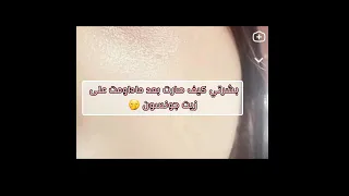 نصيحه بنات داومو عليه يعطي لمعه و ترطيب خيالي البنات التيك توك قلو اب اكسبلور ترند Blackpink 