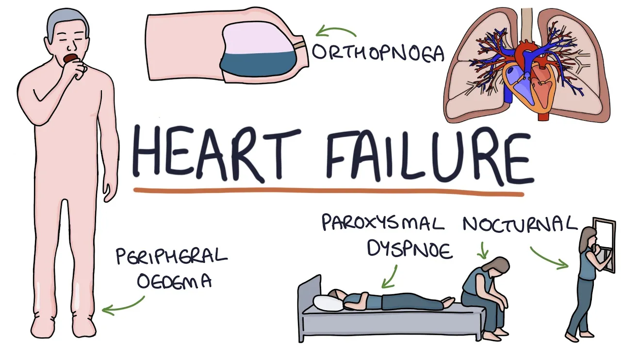 Understanding Heart Failure: Visual Explanation for Students