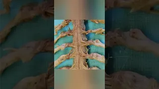 صورة مقربه للحبل الشوكي وتفرعاته العصبية اي قطع في شعره بسيطه تسبب الشلل 