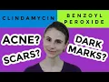 Clindamycin versus benzoyl peroxide for acne Dr Dray