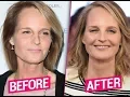 EXCLUSIVE - So Plastic Helen Hunt Unrecognizable After Facelift Claim Top Docs
