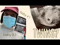 Twins Baby 1st Ultrasound High HCG Levels BOBH EP 3